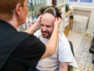 La diagnosi dell'alopecia: test e analisi fondamentali