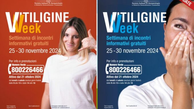 Nella “Vitiligine Week” oltre mille incontri gratuiti con i pazienti “per mettere Ko le fake news”