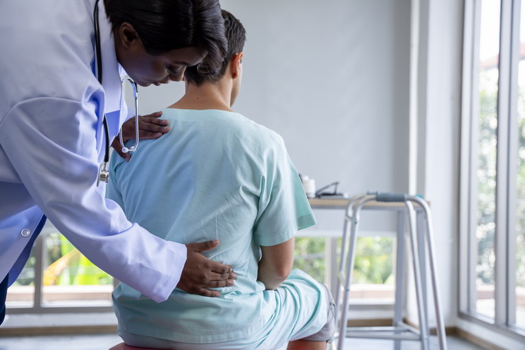 La sindrome del piriforme e il nervo sciatico