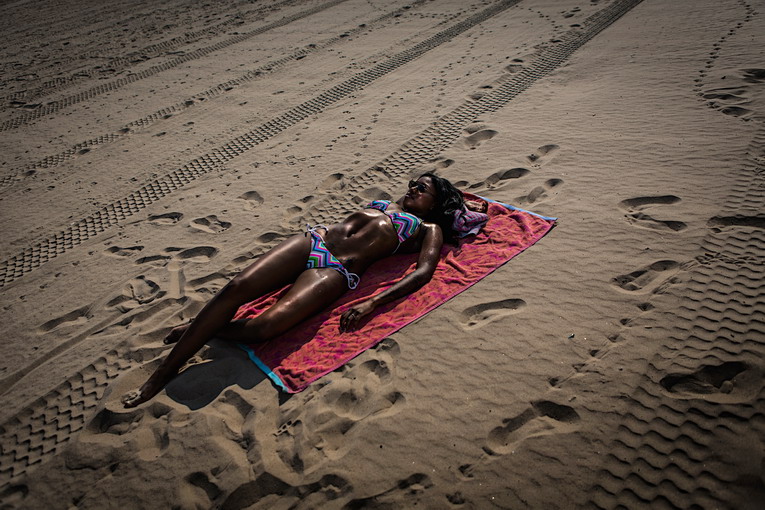 Errori da evitare dopo una scottatura solare