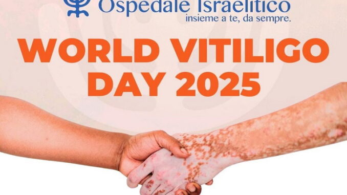 Giornata Mondiale della Vitiligine 2025: l'ospedale israelitico in prima linea Giornata Mondiale della Vitiligine 2025: l'ospedale israelitico in prima linea