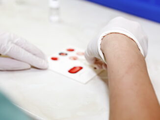 Creatinina e azotemia: la salute dei reni sotto controllo