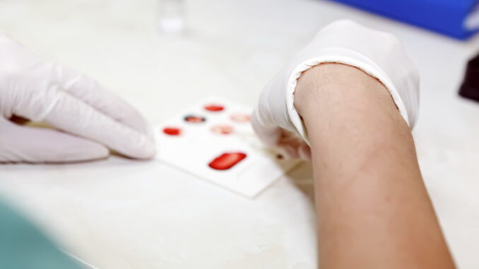 Creatinina e azotemia: la salute dei reni sotto controllo