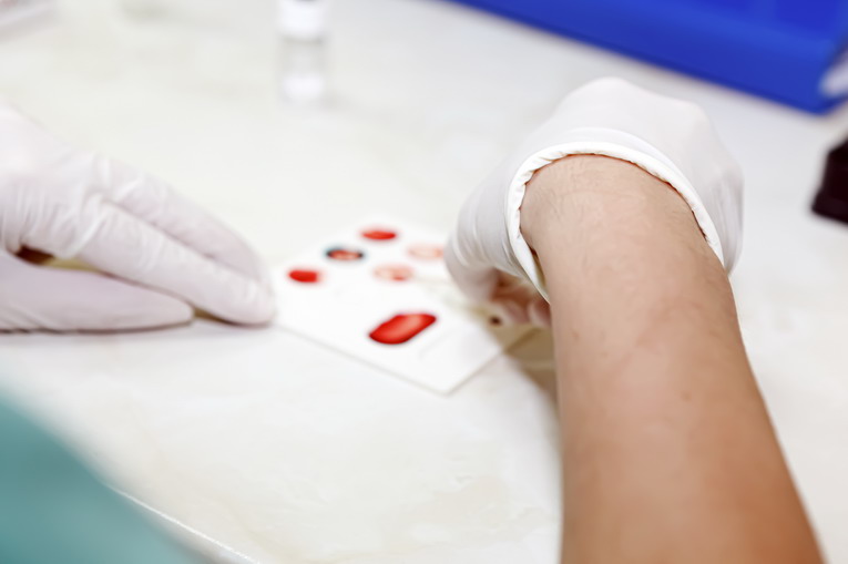 Creatinina e azotemia: la salute dei reni sotto controllo