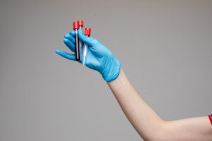 Glicemia e HbA1c: i parametri per monitorare il diabete