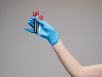 Glicemia e HbA1c: i parametri per monitorare il diabete