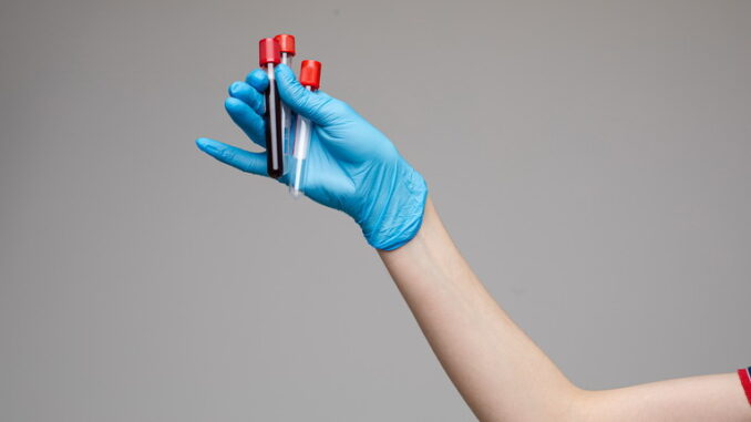 Glicemia e HbA1c: i parametri per monitorare il diabete