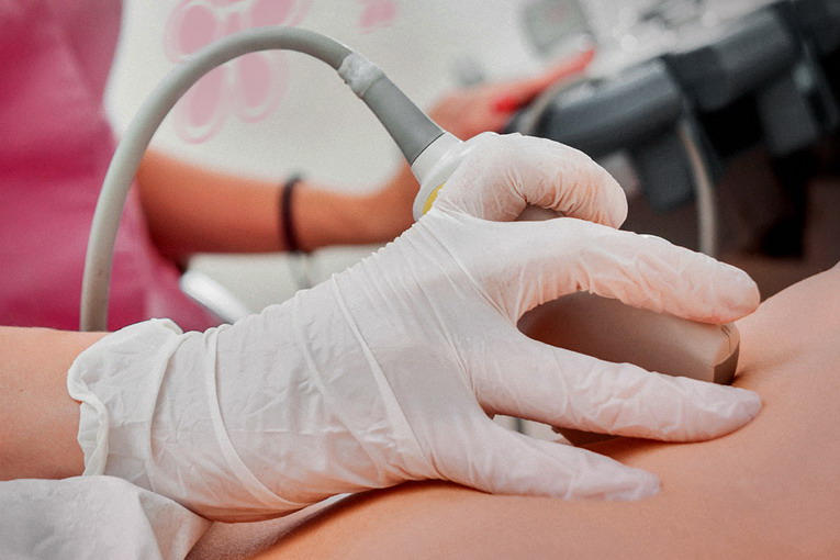 Nuovi Lea: un passo avanti per la sanità, ma l'endometriosi resta nell'ombra